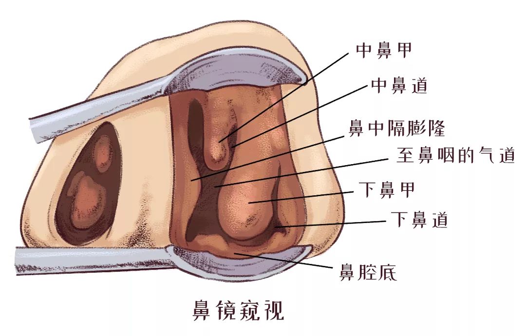 鼻甲肥大引起的呼吸困難怎么辦？(圖2)