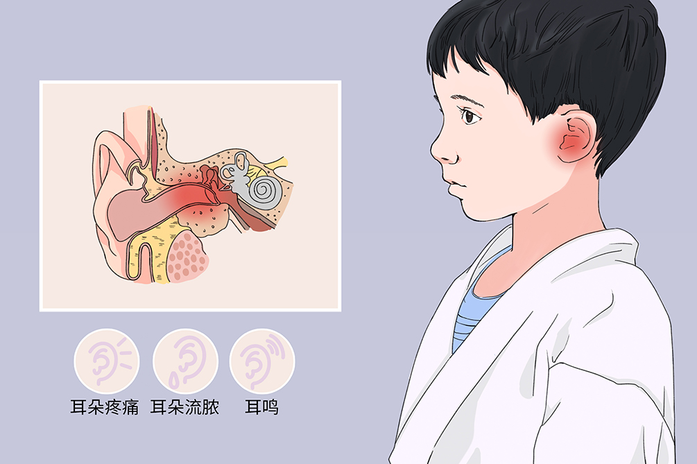 中耳炎雖小，但其危害不容小覷！(圖1)