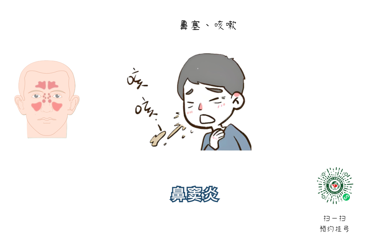 鼻竇炎發(fā)作頭痛欲裂，治好鼻竇炎的三個方法，快試試(圖1)